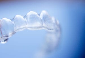 invisible braces
