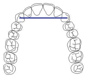 cantilever bridge diagram